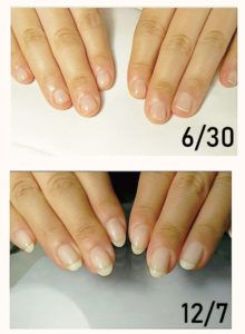 自爪育成ビフォーアフター